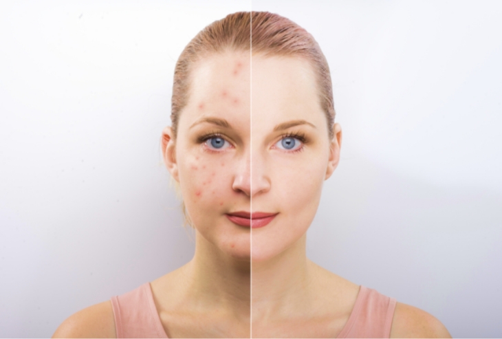 Before & After Skin